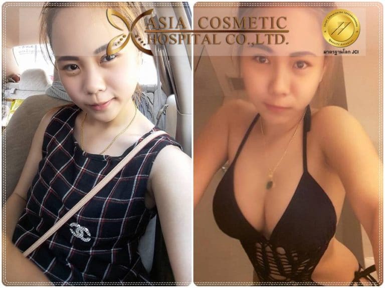 เสริมนม 350cc